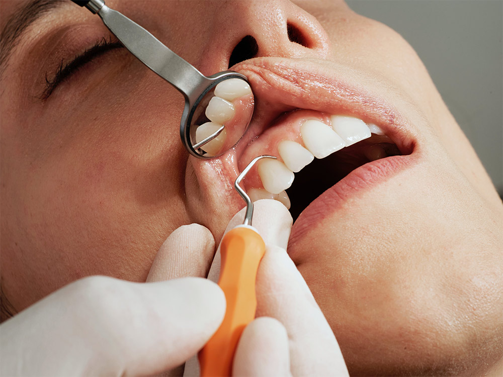 Woman having teeth examined at dentist
